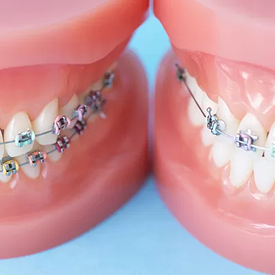 矯正歯科への取り組み